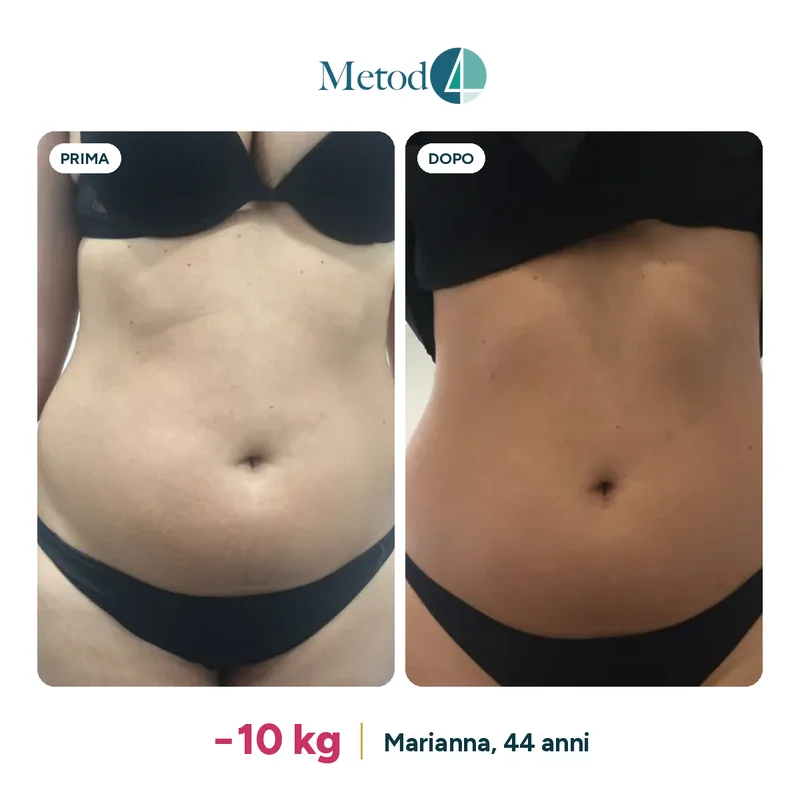 Prima e dopo il percorso di Marianna, 44 anni